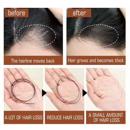 Eelhoe 100% Unrefined Batana Oil Hair Conditioner